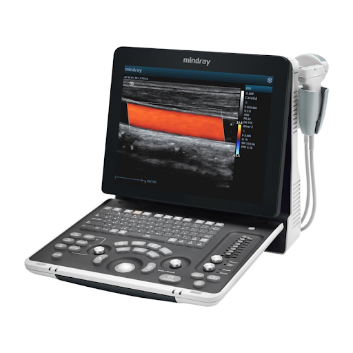 The Z6 portable Color Doppler ultrasound system